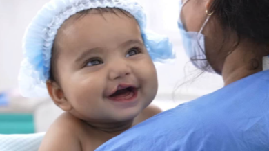 Understanding Cleft Lip: Causes, Treatments, and Hope